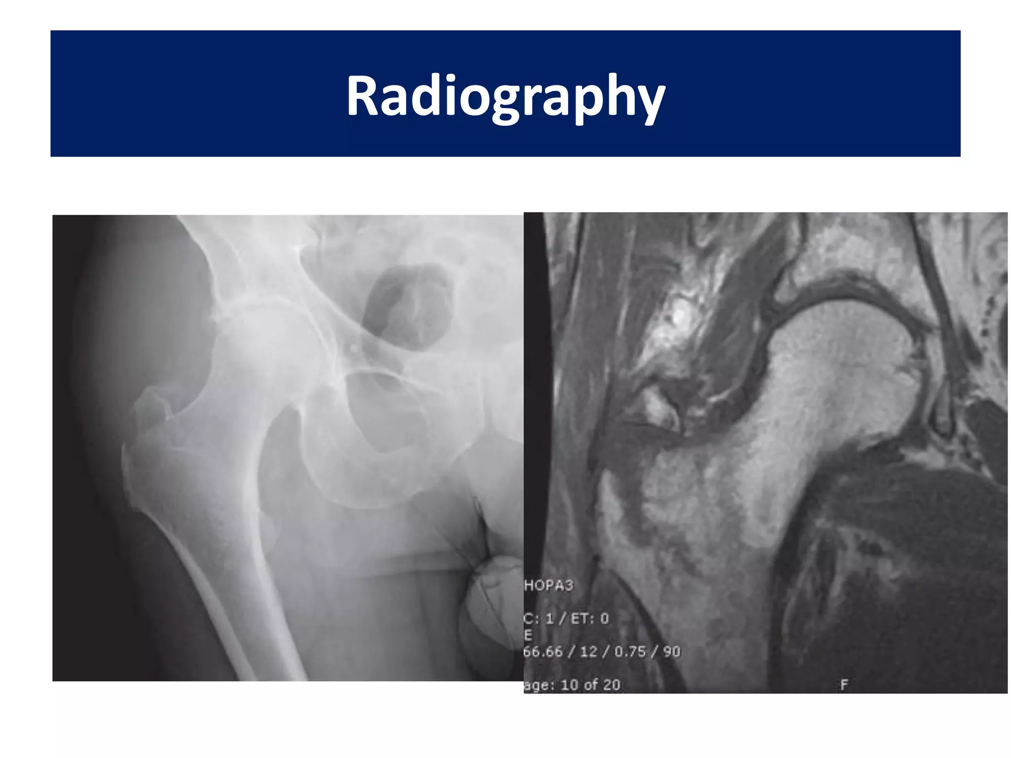 Radiography
 