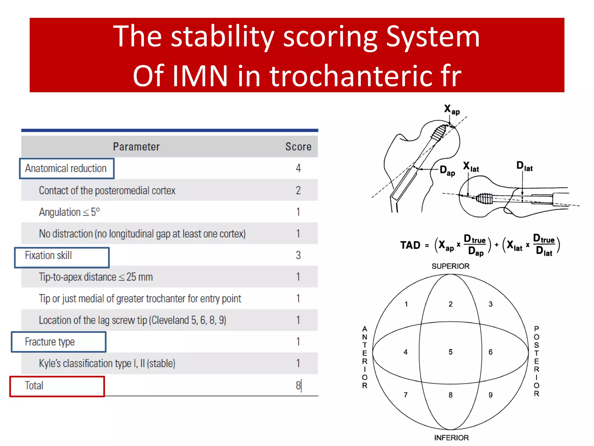 The stability scoring System
Of IMN in trochanteric fr
 