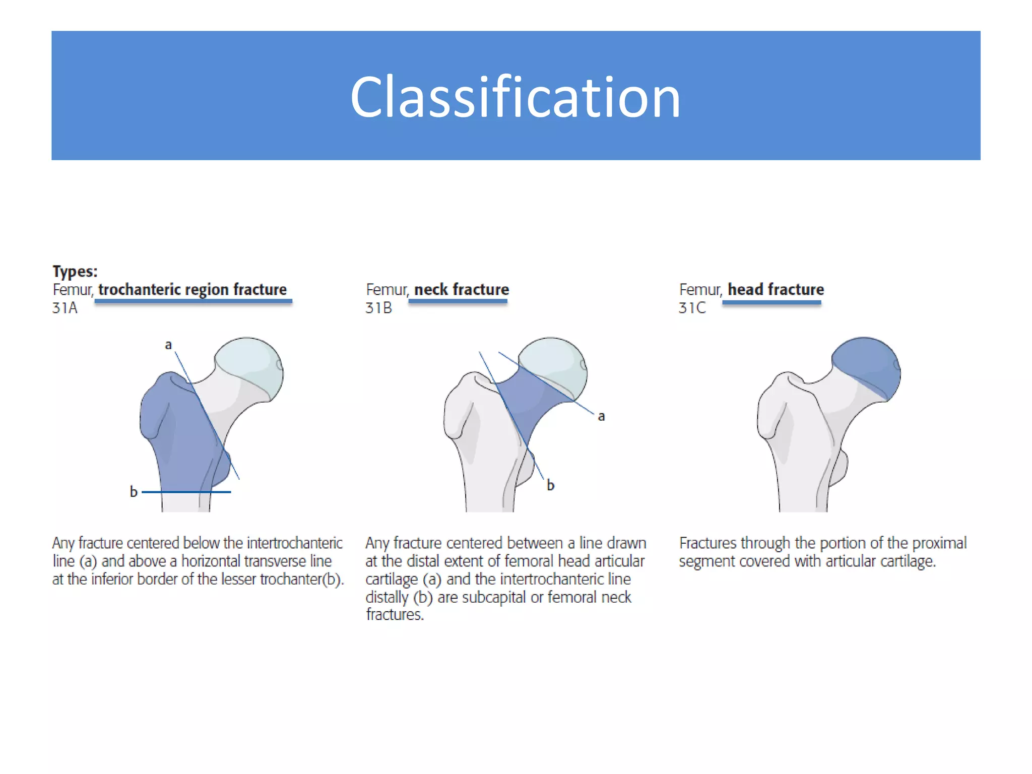Classification
 