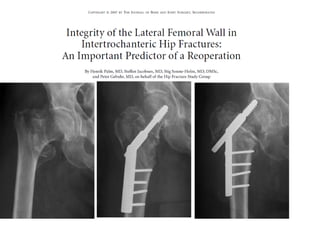 Proximal femoral fractures