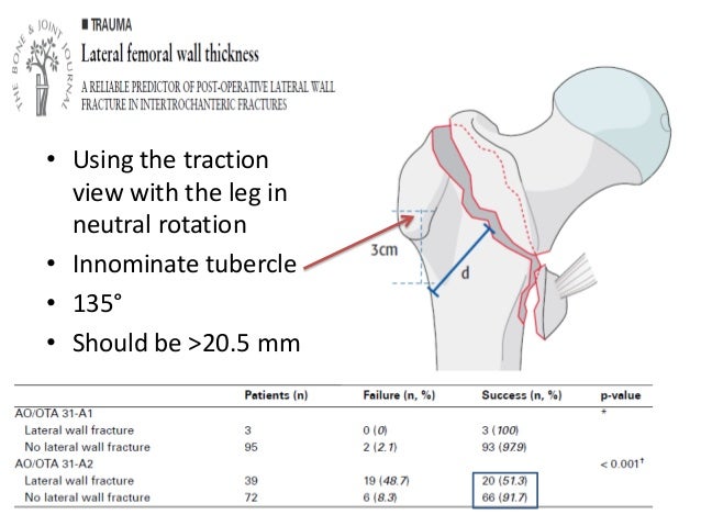 Proximal femoral fractures