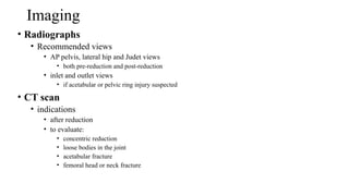 Proximal femur fracture ppt .pptxMNNNNNNNNN | PPTX