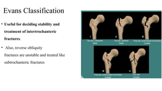 Proximal femur fracture ppt .pptxMNNNNNNNNN | PPTX