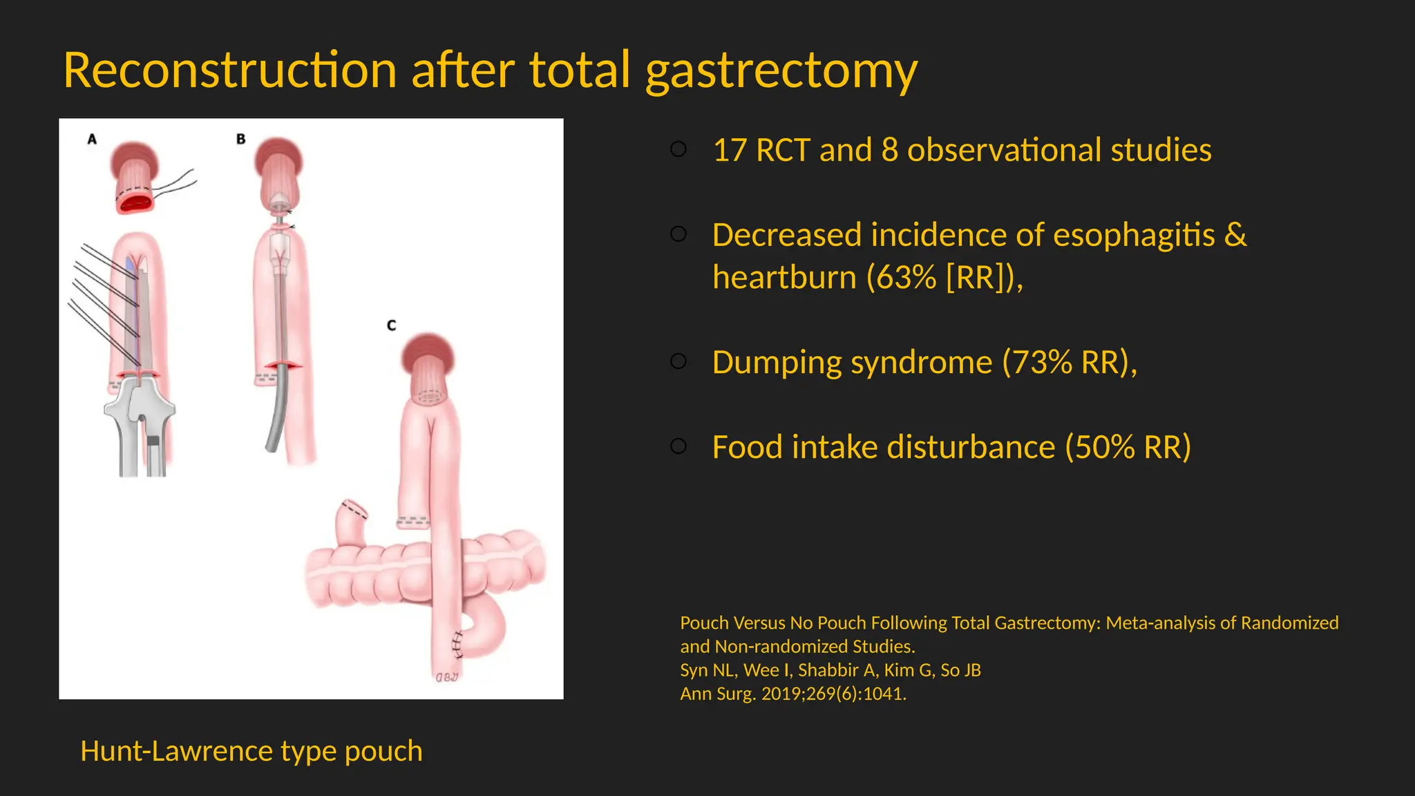 Reconstruction after total gastrectomy
Hunt-Lawrence type pouch
Pouch Versus No Pouch Following Total Gastrectomy: Meta-analysis of Randomized
and Non-randomized Studies.
Syn NL, Wee I, Shabbir A, Kim G, So JB
Ann Surg. 2019;269(6):1041.
o 17 RCT and 8 observational studies
o Decreased incidence of esophagitis &
heartburn (63% [RR]),
o Dumping syndrome (73% RR),
o Food intake disturbance (50% RR)
 