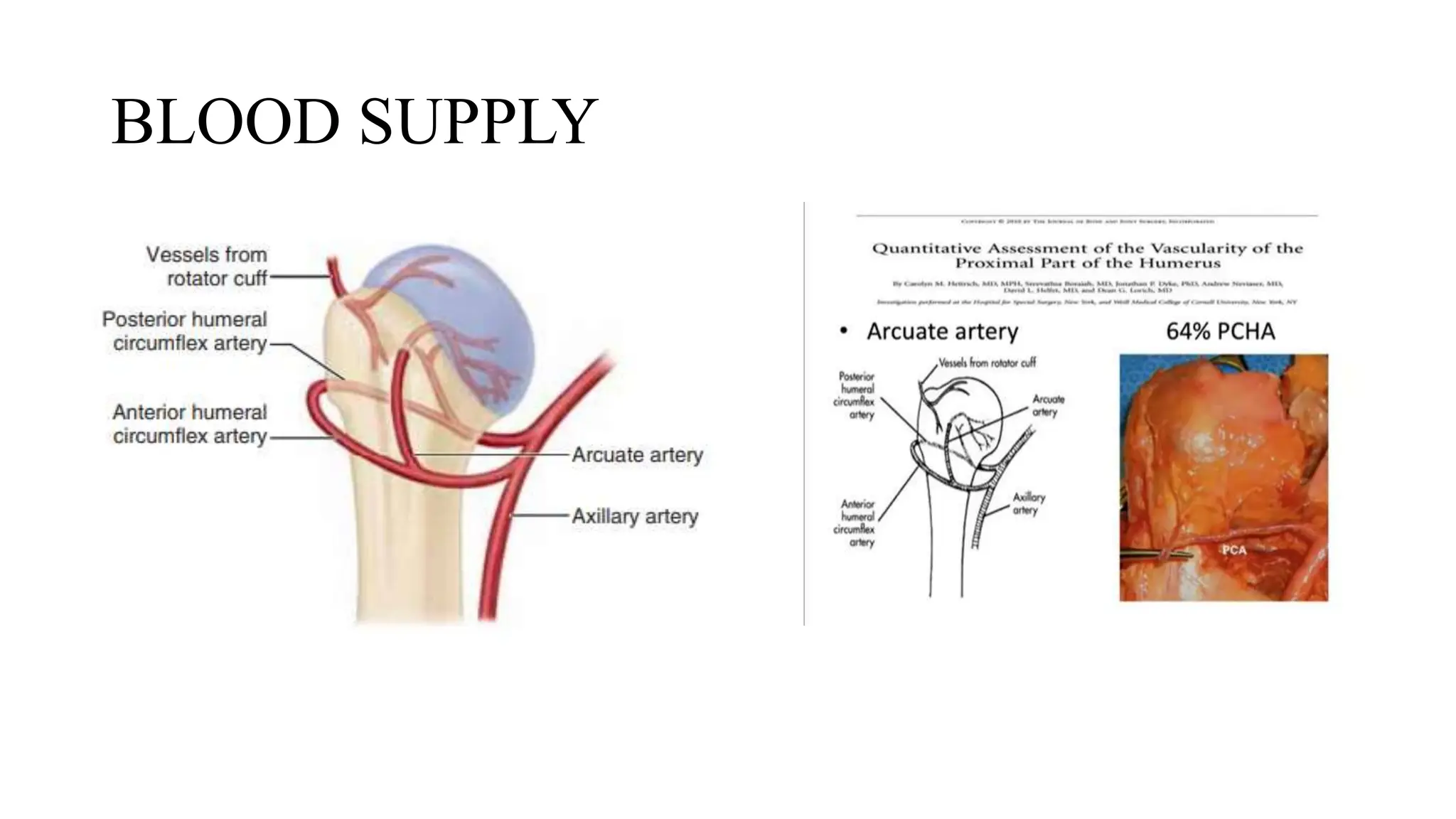 PROXIMAL HUMERUS FRACTURE TREATMENT.pptx