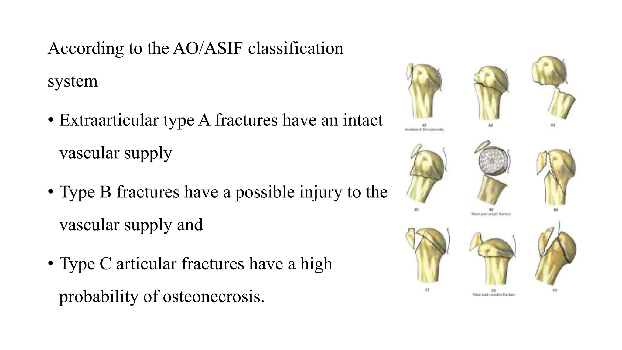 PROXIMAL HUMERUS FRACTURE TREATMENT.pptx