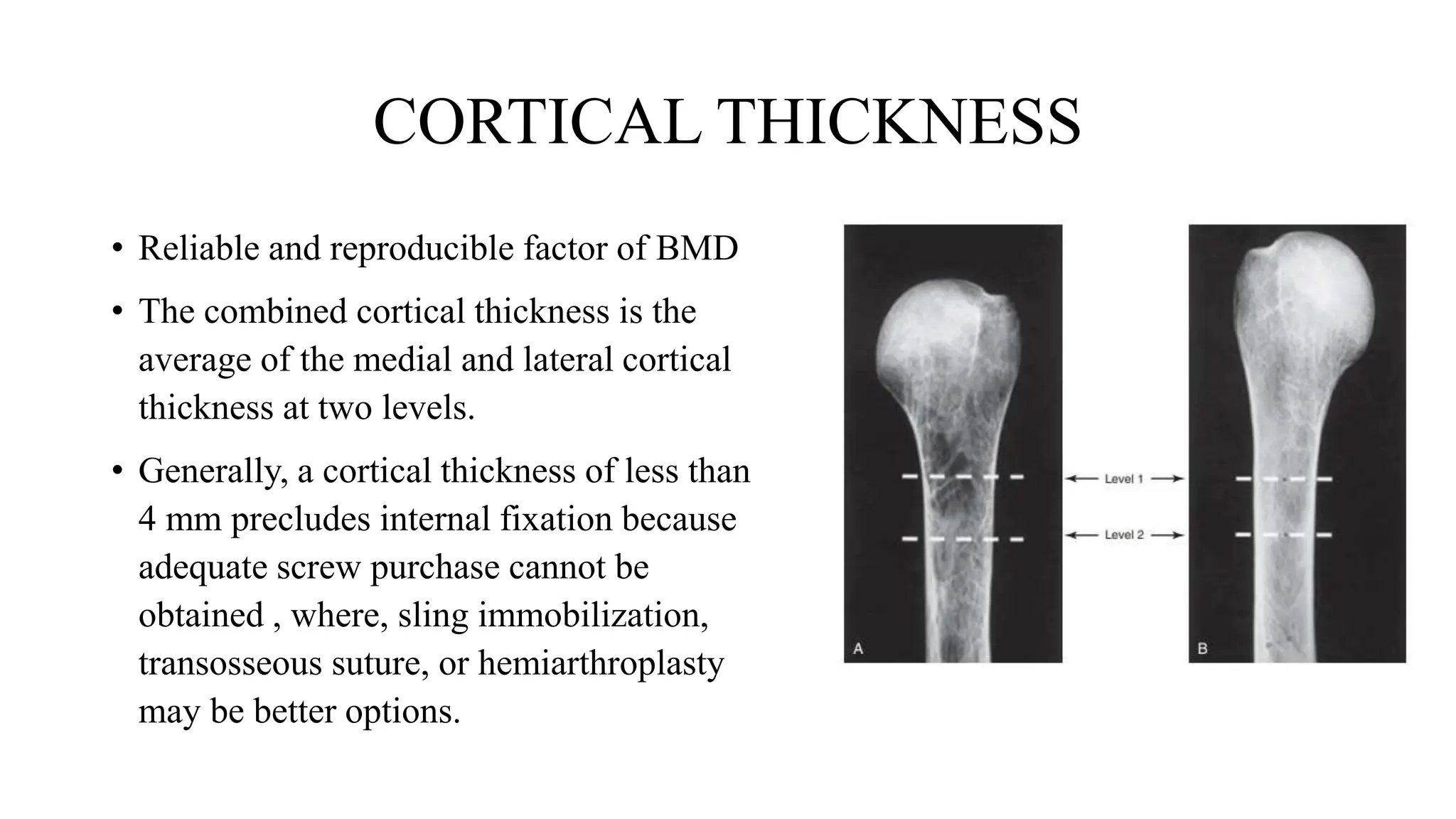 PROXIMAL HUMERUS FRACTURE TREATMENT.pptx