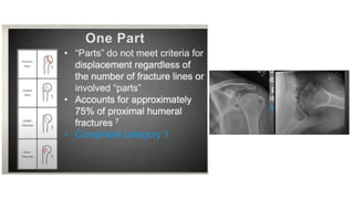 PROXIMAL HUMERUS FRACTURE TREATMENT.pptx