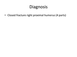 Diagnosis
• Closed fracture right proximal humerus (4 parts)
 