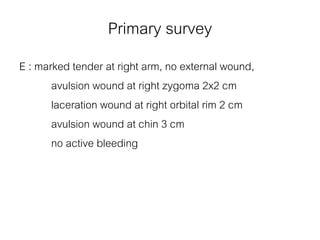 Primary survey
E : marked tender at right arm, no external wound,
avulsion wound at right zygoma 2x2 cm
laceration wound at right orbital rim 2 cm
avulsion wound at chin 3 cm
no active bleeding
 