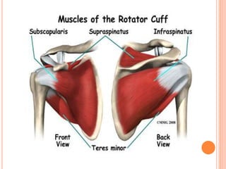 Proximal humerus fractures | PPTX