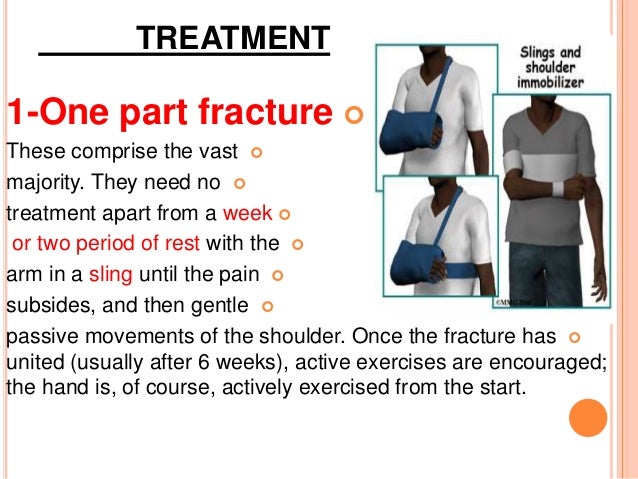 Proximal humerus fractures