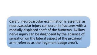 Careful neurovascular examination is essential as
neurovascular injury can occur in fractures with a
medially displaced shaft of the humerus. Axillary
nerve injury can be diagnosed by the absence of
sensation on the lateral aspect of the proximal
arm (referred as the ‘regiment badge area’).
 