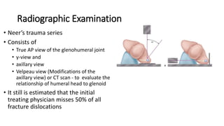Radiographic Examination
• Neer’s trauma series
• Consists of
• True AP view of the glenohumeral joint
• y-view and
• axillary view
• Velpeau view (Modifications of the
axillary view) or CT scan - to evaluate the
relationship of humeral head to glenoid
• It still is estimated that the initial
treating physician misses 50% of all
fracture dislocations
 