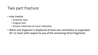 Two part fracture
• may involve
• Anatomic neck
• Surgical neck
• Greater tuberosity or Lesser tuberosity
• When one fragment is displaced at least one centimeter or angulated
45° or more with respect to any of the remaining three fragments
 