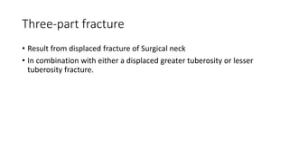 Three-part fracture
• Result from displaced fracture of Surgical neck
• In combination with either a displaced greater tuberosity or lesser
tuberosity fracture.
 