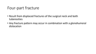 Four-part fracture
• Result from displaced fractures of the surgical neck and both
tuberosities
• Any fracture pattern may occur in combination with a glenohumeral
dislocation
 