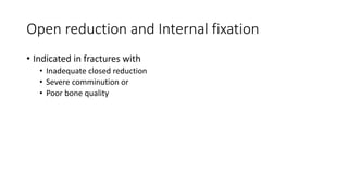 Open reduction and Internal fixation
• Indicated in fractures with
• Inadequate closed reduction
• Severe comminution or
• Poor bone quality
 