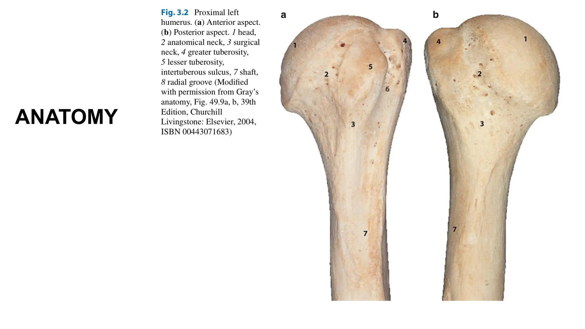 Upper limb trauma : Proximal Humerus Fractures | PPT