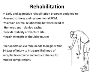 Rehabilitation
 Early and aggressive rehabilitation program designed to :
•Prevent stiffness and restore nomal ROM.
•Maintain normal relationship between head of
Humerus and gleniod cavity.
•Provide stability at Fracture site
•Regain strength of shoulder musles
• Rehabilitation exercise needs to begin within
14 days of injury to increase likelihood of
acceptable outcome and reduce chance for
motion complications
 