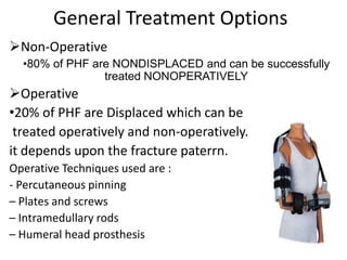 General Treatment Options
Non-Operative
•80% of PHF are NONDISPLACED and can be successfully
treated NONOPERATIVELY
Operative
•20% of PHF are Displaced which can be
treated operatively and non-operatively.
it depends upon the fracture paterrn.
Operative Techniques used are :
- Percutaneous pinning
– Plates and screws
– Intramedullary rods
– Humeral head prosthesis
 