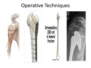 Operative Techniques
 