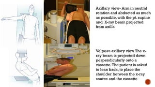 proximal part of humerus fructure. .pptx