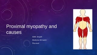 Proximal myopathy and
causes
AAM. Amjath
Medicine 4th batch
Fhcs-eusl
 
