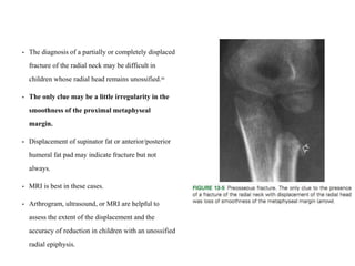 • The diagnosis of a partially or completely displaced
fracture of the radial neck may be difficult in
children whose radial head remains unossified.88
• The only clue may be a little irregularity in the
smoothness of the proximal metaphyseal
margin.
• Displacement of supinator fat or anterior/posterior
humeral fat pad may indicate fracture but not
always.
• MRI is best in these cases.
• Arthrogram, ultrasound, or MRI are helpful to
assess the extent of the displacement and the
accuracy of reduction in children with an unossified
radial epiphysis.
 