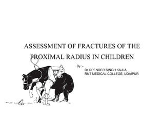 ASSESSMENT OF FRACTURES OF THE
PROXIMAL RADIUS IN CHILDREN
By :-
Dr OPENDER SINGH KAJLA
RNT MEDICAL COLLEGE, UDAIPUR
 