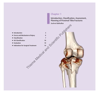 Chapter 8
Early Complications following
Proximal Tibia Fractures
● Disturbed healing of soft-tissue envelope 00
● Postoperative hematoma 00
● Compartment syndrome 00
● Wound infection 00
● DVT/TE 00
● Postoperative damage of peroneal nerve 00
● Postoperatively recognized deﬁcits of
osteosynthesis 00
Chapter 1
Introduction, Classiﬁcation, Assessment,
Planning of Proximal Tibia Fractures
Sushrut Babhulkar
● Introduction 3
● Forces and Mechanism of Injury 6
● Classiﬁcation 7
● AO Classiﬁcation 10
● Evaluation 10
● Indications for Surgical Treatment 14
Thiem
e
M
edicaland
Scientific
Publishers
 