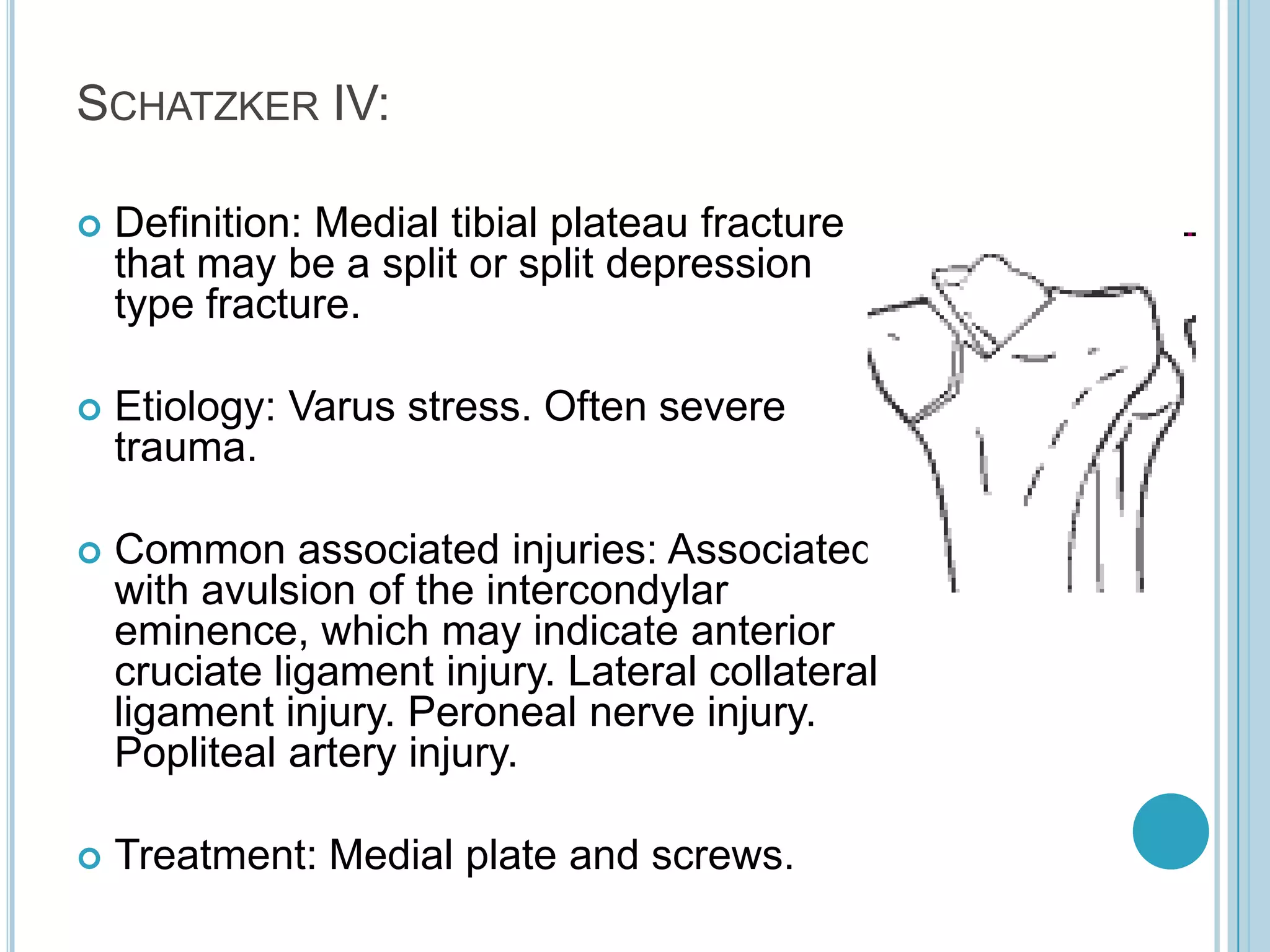 Proximal tibia fracture | PPTX
