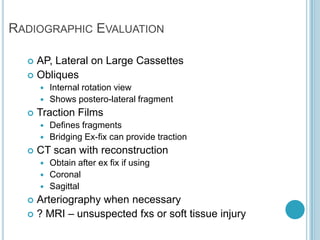 Traction Internal Rotation View Proximal tibia fracture | PPTX