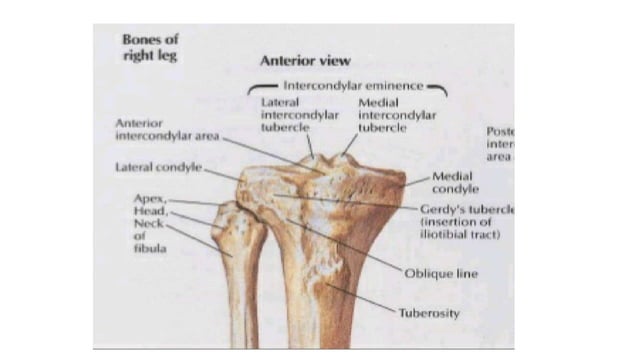 Proximal tibia fractures(Plateau, spine ,Tubercle and Epiphyseal ...
