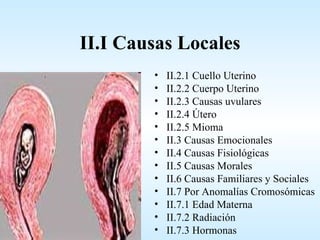 II.I Causas Locales
        •   II.2.1 Cuello Uterino
        •   II.2.2 Cuerpo Uterino
        •   II.2.3 Causas uvulares
        •   II.2.4 Útero
        •   II.2.5 Mioma
        •   II.3 Causas Emocionales
        •   II.4 Causas Fisiológicas
        •   II.5 Causas Morales
        •   II.6 Causas Familiares y Sociales
        •   II.7 Por Anomalías Cromosómicas
        •   II.7.1 Edad Materna
        •   II.7.2 Radiación
        •   II.7.3 Hormonas
 