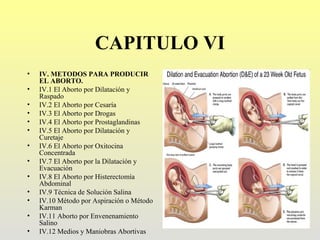 CAPITULO VI
•   IV. METODOS PARA PRODUCIR
    EL ABORTO.
•   IV.1 El Aborto por Dilatación y
    Raspado
•   IV.2 El Aborto por Cesaría
•   IV.3 El Aborto por Drogas
•   IV.4 El Aborto por Prostaglandinas
•   IV.5 El Aborto por Dilatación y
    Curetaje
•   IV.6 El Aborto por Oxitocina
    Concentrada
•   IV.7 El Aborto por la Dilatación y
    Evacuación
•   IV.8 El Aborto por Histerectomía
    Abdominal
•   IV.9 Técnica de Solución Salina
•   IV.10 Método por Aspiración o Método
    Karman
•   IV.11 Aborto por Envenenamiento
    Salino
•   IV.12 Medios y Maniobras Abortivas
 