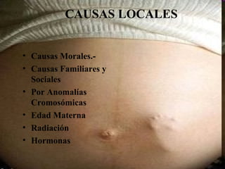 CAUSAS LOCALES


• Causas Morales.-
• Causas Familiares y
  Sociales
• Por Anomalías
  Cromosómicas
• Edad Materna
• Radiación
• Hormonas
 
