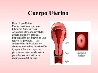 Cuerpo Uterino
•   Útero hipoplásico,
    Malformaciones Uterinas,
    Fibromas Submucosos,
    Anidación Ovular a nivel del
    ostium uterino y cervical.
    Implantación del huevo en una
    región no propicia. Las
    endometritis infecciosas de
    diversas etiologías: retroflexión
    fija por adherencia que no
    permiten el ascenso del útero
    grávido conduciendo a la
    incurvación del mismo.
 