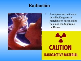 Radiación
      •   La exposición materna a
          la radiación guardan
          relación con nacimientos
          de niños con Síndrome
          de Down
 