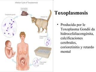 Toxoplasmosis

 • Producida por le
   Toxoplasma Gondii da
   hidrocefaliacongénita,
   calcificaciones
   cerebrales,
   corioretinitis y retardo
   mental
 
