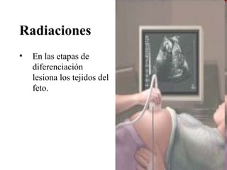 Radiaciones
•   En las etapas de
    diferenciación
    lesiona los tejidos del
    feto.
 