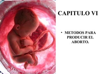 CAPITULO VI


• METODOS PARA
   PRODUCIR EL
     ABORTO.
 