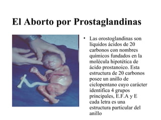 El Aborto por Prostaglandinas
                • Las orostoglandinas son
                  líquidos ácidos de 20
                  carbonos con nombres
                  químicos fundados en la
                  molécula hipotética de
                  ácido prostanoico. Esta
                  estructura de 20 carbonos
                  posee un anillo de
                  ciclopentano cuyo carácter
                  identifica 4 grupos
                  principales, E.F.A y E
                  cada letra es una
                  estructura particular del
                  anillo
 