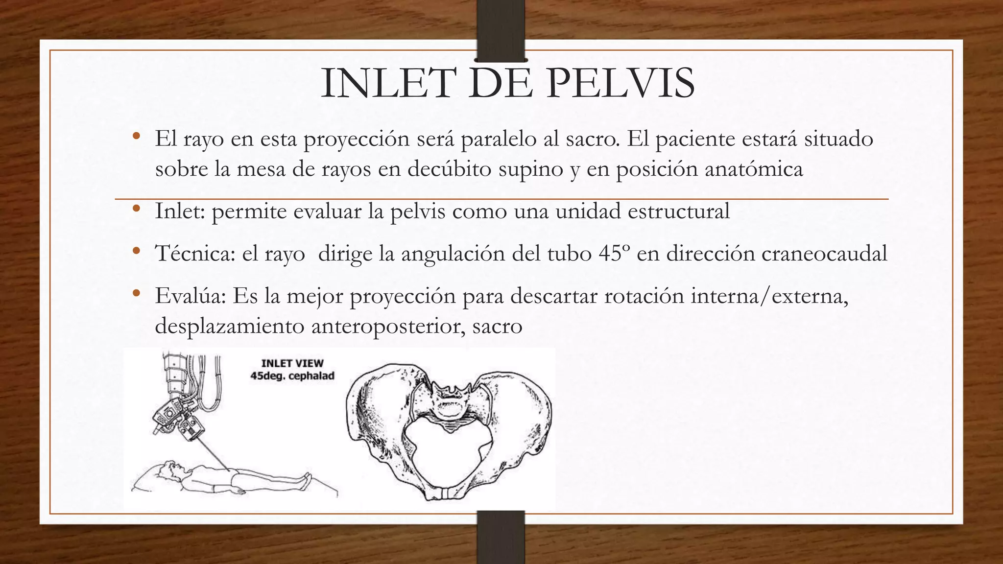 Proyección de pelvis inlet outlet | PPTX