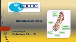 Presentado por:
Elba Rodríguez 3-744-154
Radiografías de Tobillo
 