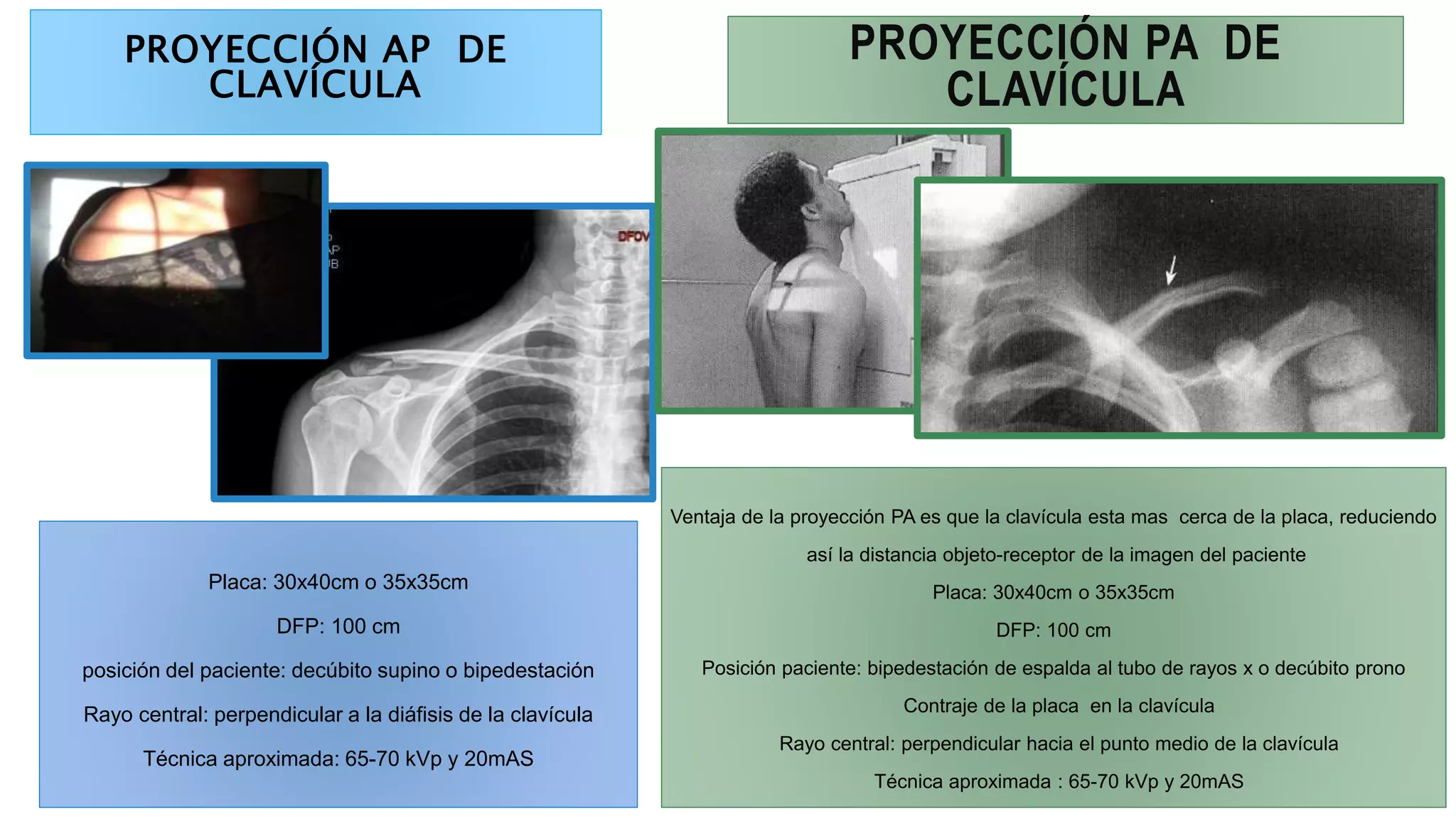 Proyecciones de cintura escapular | PPTX