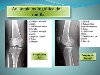 Anatomía radiográfica de la
rodilla
Proyección
AP
Proyección
Lateral
 