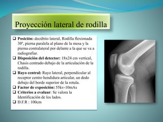 Proyección lateral de rodilla
 Posición: decúbito lateral, Rodilla flexionada
30º, pierna paralela al plano de la mesa y la
pierna contralateral por delante a la que se va a
radiografiar.
 Disposición del detector: 18x24 cm vertical,
Chasis centrado debajo de la articulación de la
rodilla.
 Rayo central: Rayo lateral, perpendicular al
receptor centro hendidura articular, un dedo
debajo del borde superior de la rotula.
 Factor de exposición: 55kv-10mAs
 Criterios a evaluar: Se valora la
Identificación de los lados.
 D.F.R : 100cm
 