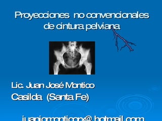 Proyecciones  no convencionales de cintura pelviana <ul><li>Lic. Juan José Montico </li></ul><ul><li>Casilda  (Santa Fe) <...