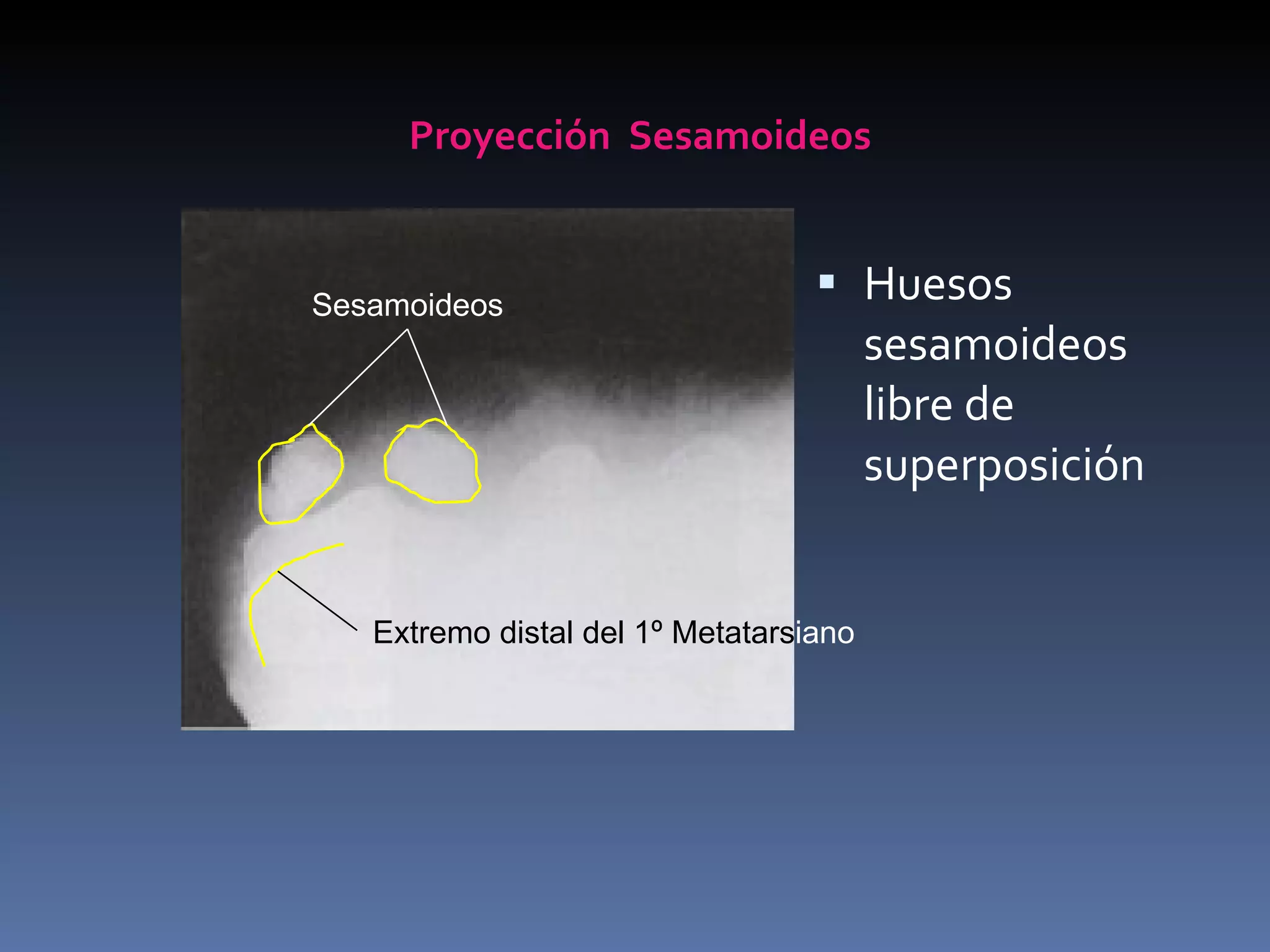 Proyecciones Radiologicas Miembro Inferior | PPT